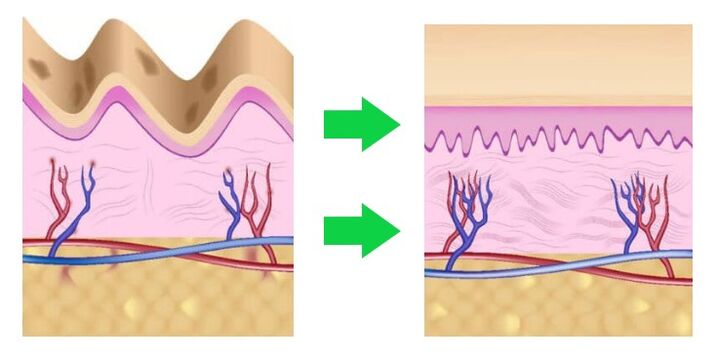 Intenskin is suitable for the skin