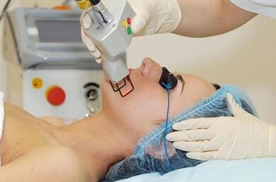 Laser face skin rejuvenation types
